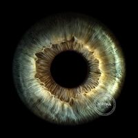 Green-grey iris with a dark brown central ring and pale blue-green fibres radiating outward.