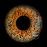 Blue-grey iris with vivid orange branching patterns radiating from the pupil.