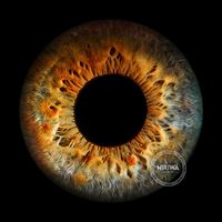 Hazel iris with a fiery golden-orange centre, blue-grey outer tones and intricate dark radial markings.