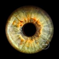 Pale green-grey iris with a golden-brown ring around the pupil and delicate radial fibres.